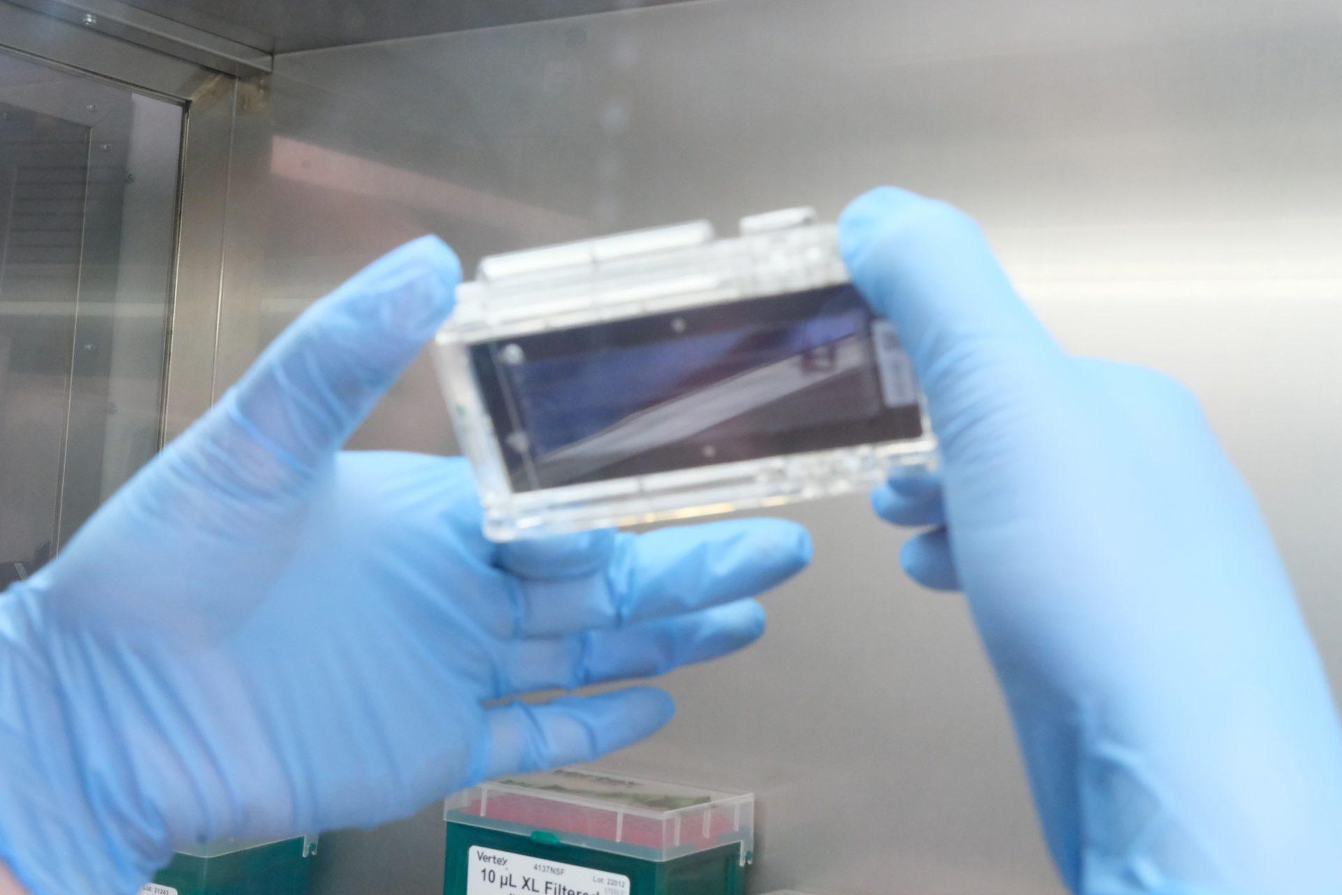 MOLECULAR GENETIC STUDY ARIADNA HELPED DETECT A NEW MUTATION IN BREAST CANCER