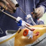 THE PATIENT FACED THE REMOVAL OF HER ENTIRE STOMACH, BUT NMRRC SURGEONS REFUSED TO ACCEPT THIS OUTCOME