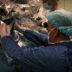 NEUROSURGEONS AT THE NATIONAL MEDICAL RESEARCH RADIOLOGICAL CENTRE REMOVED DANGEROUS TUMOR GROWING ON THE AUDITORY NERVE