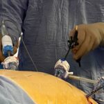 igjhzdobz pcwb1zkcx sb1xl ulugyo2ulpzvvixyetckativbd00tgzleejb5zu5qgy6pr6acfarpwr sx lee