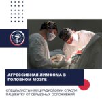 AGGRESSIVE BRAIN LYMPHOMA: SPECIALISTS FROM THE NATIONAL MEDICAL RESEARCH RADIOLOGICAL CENTRE SAVED A PATIENT FROM SEVERE COMPLICATIONS
