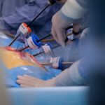 FOR THE FIRST TIME IN RUSSIA, NEW SURGICAL TECHNIQUE FOR STOMACH CANCER MASTERED AT THE NATIONAL MEDICAL RESEARCH RADIOLOGICAL CENTRE