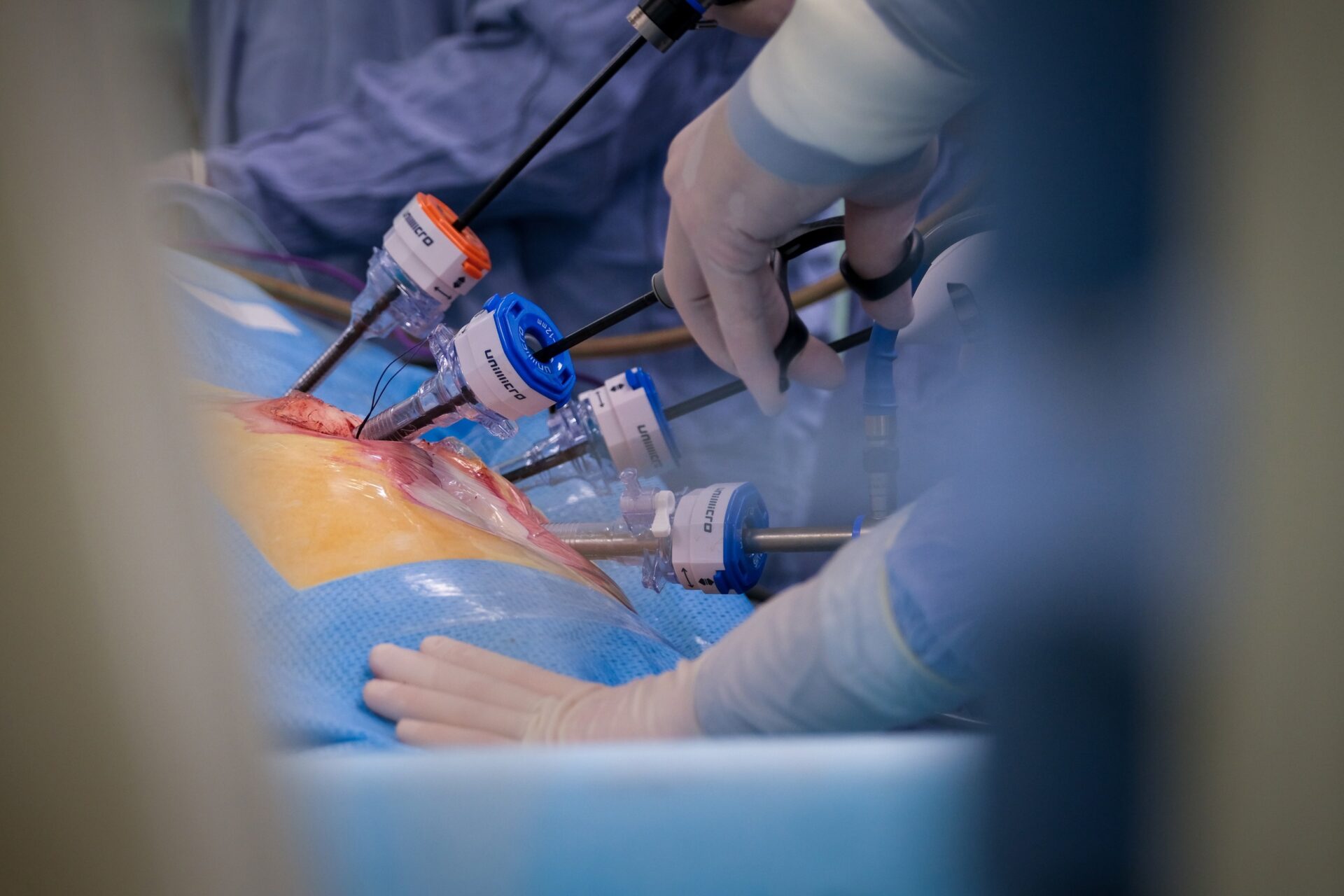 FOR THE FIRST TIME IN RUSSIA, NEW SURGICAL TECHNIQUE FOR STOMACH CANCER MASTERED AT THE NATIONAL MEDICAL RESEARCH RADIOLOGICAL CENTRE