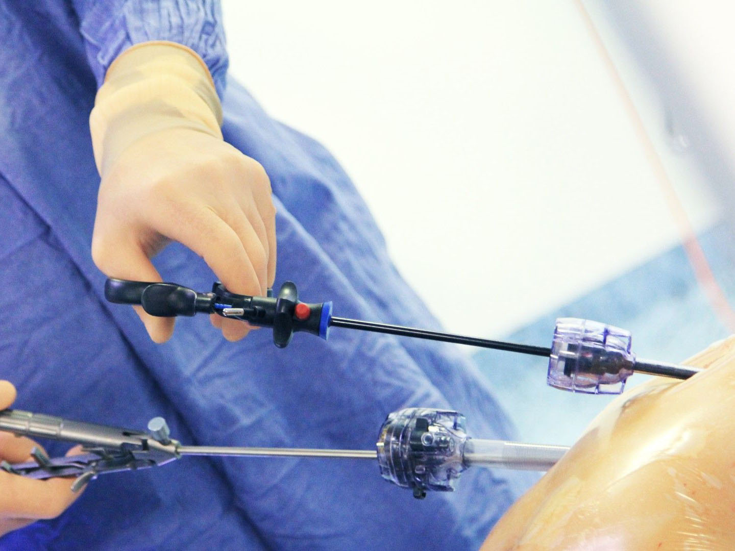 лапароскопическая операция 2 (КОПИЯ)