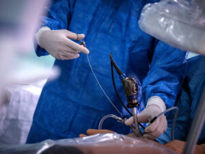 Меринов эндоскопическая операция