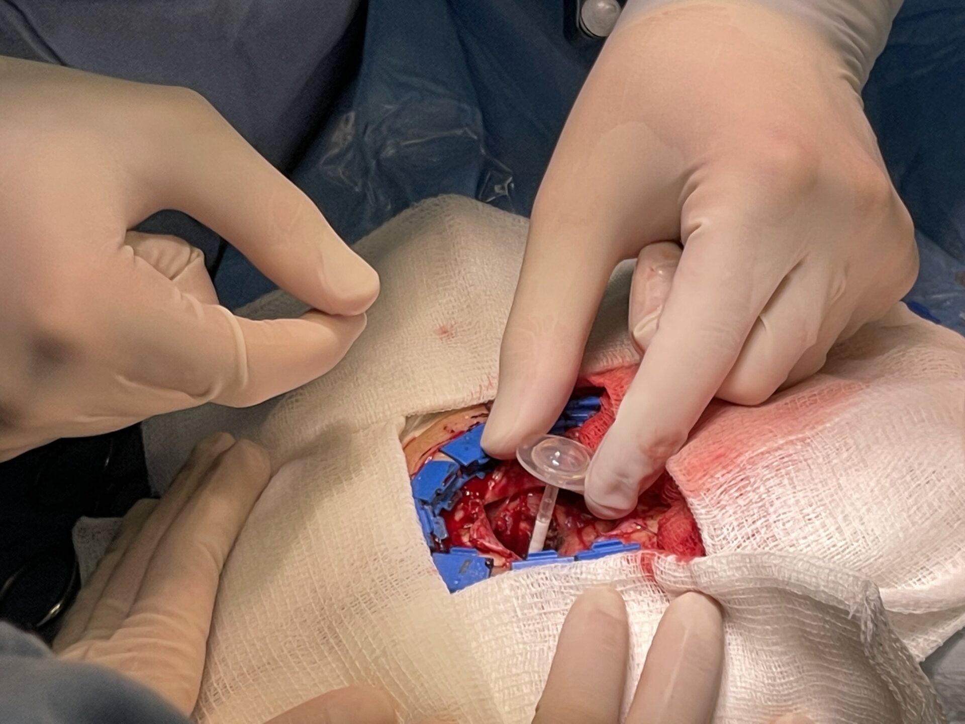 smtknyv6c6jhj7oqyc3lnzctbazpzssmjgassxbcqwe b6agrochvqxus62 gnqerdy72c4aamfp1bi45vvhnc0h