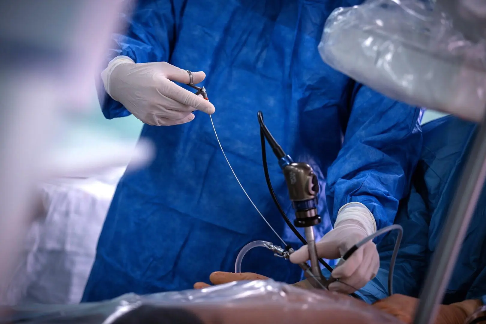 Меринов эндоскопическая операция (1)