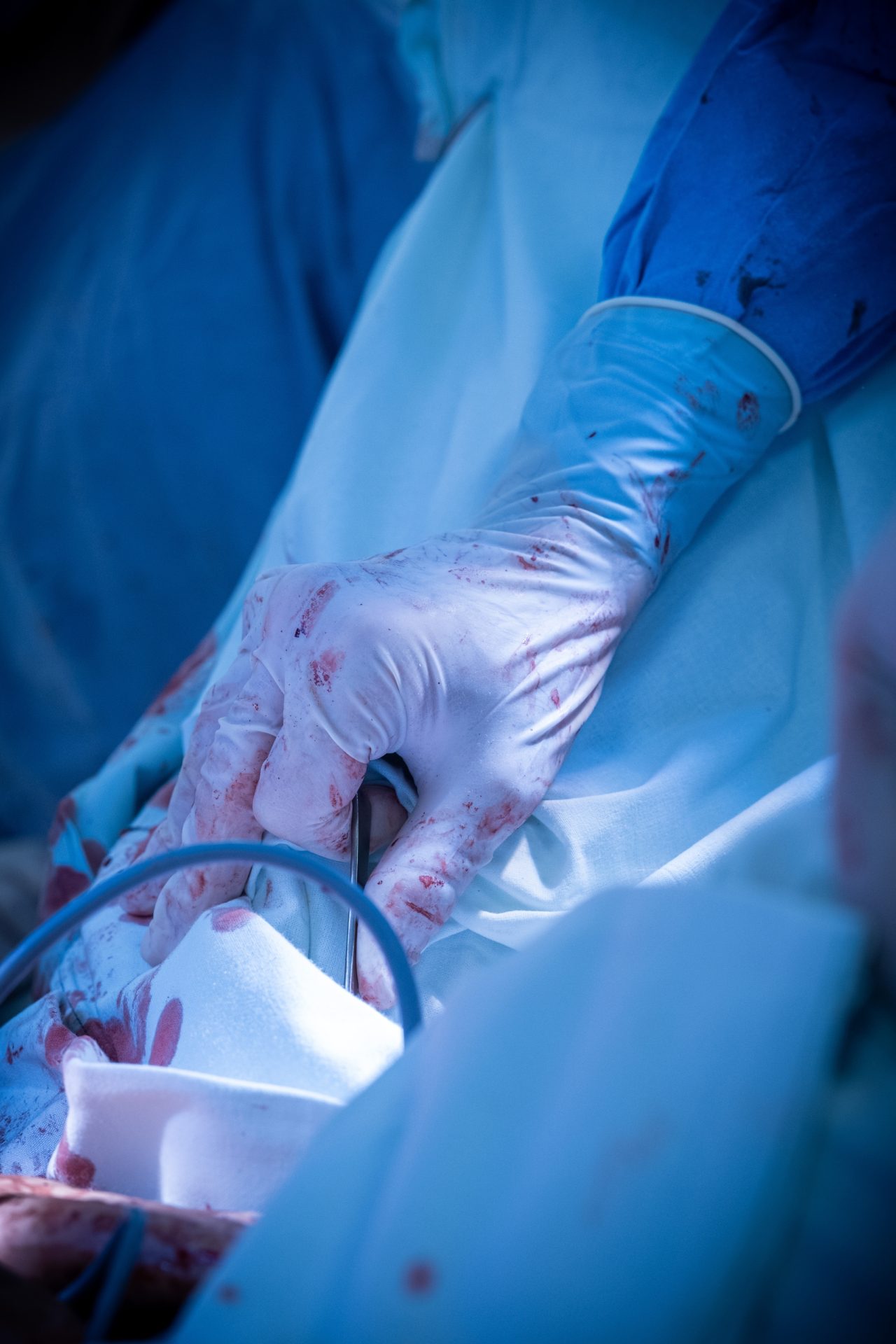 xejfroobrpj8fupi0ow9inkvuojb3a7ichhnux9jzaawmnvgreqelp8e752x72cpofjccwafpij6tp8xlxbc svu