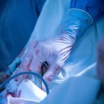 xejfroobrpj8fupi0ow9inkvuojb3a7ichhnux9jzaawmnvgreqelp8e752x72cpofjccwafpij6tp8xlxbc svu