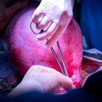 5lp6coww7flqvyzyc0epelgxzi456osr9 oie1swjht25hl5bt3jugffnbvrom7u7wabgw wxijj skyoi ulp3