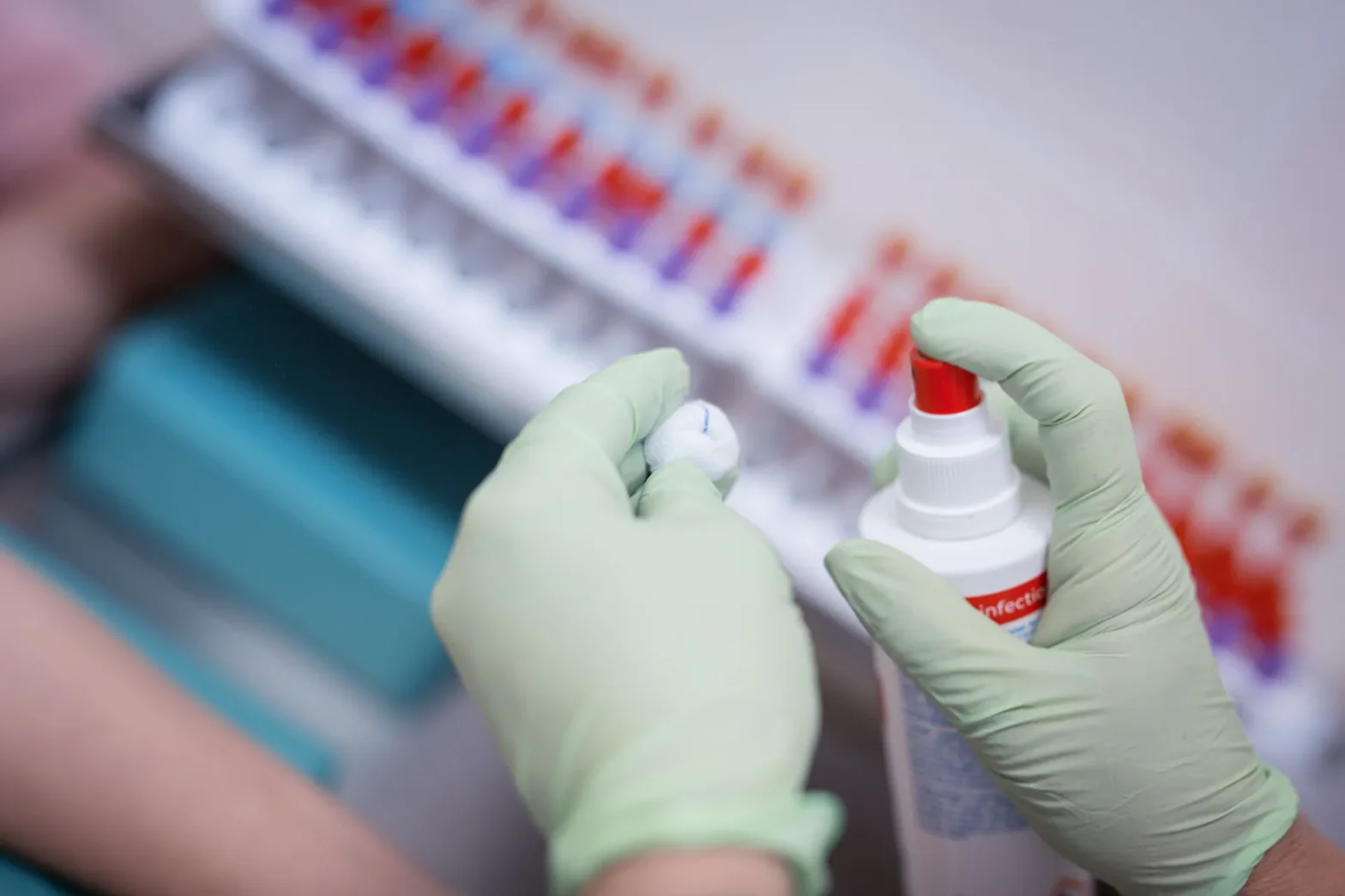 пробирка и анализ урология