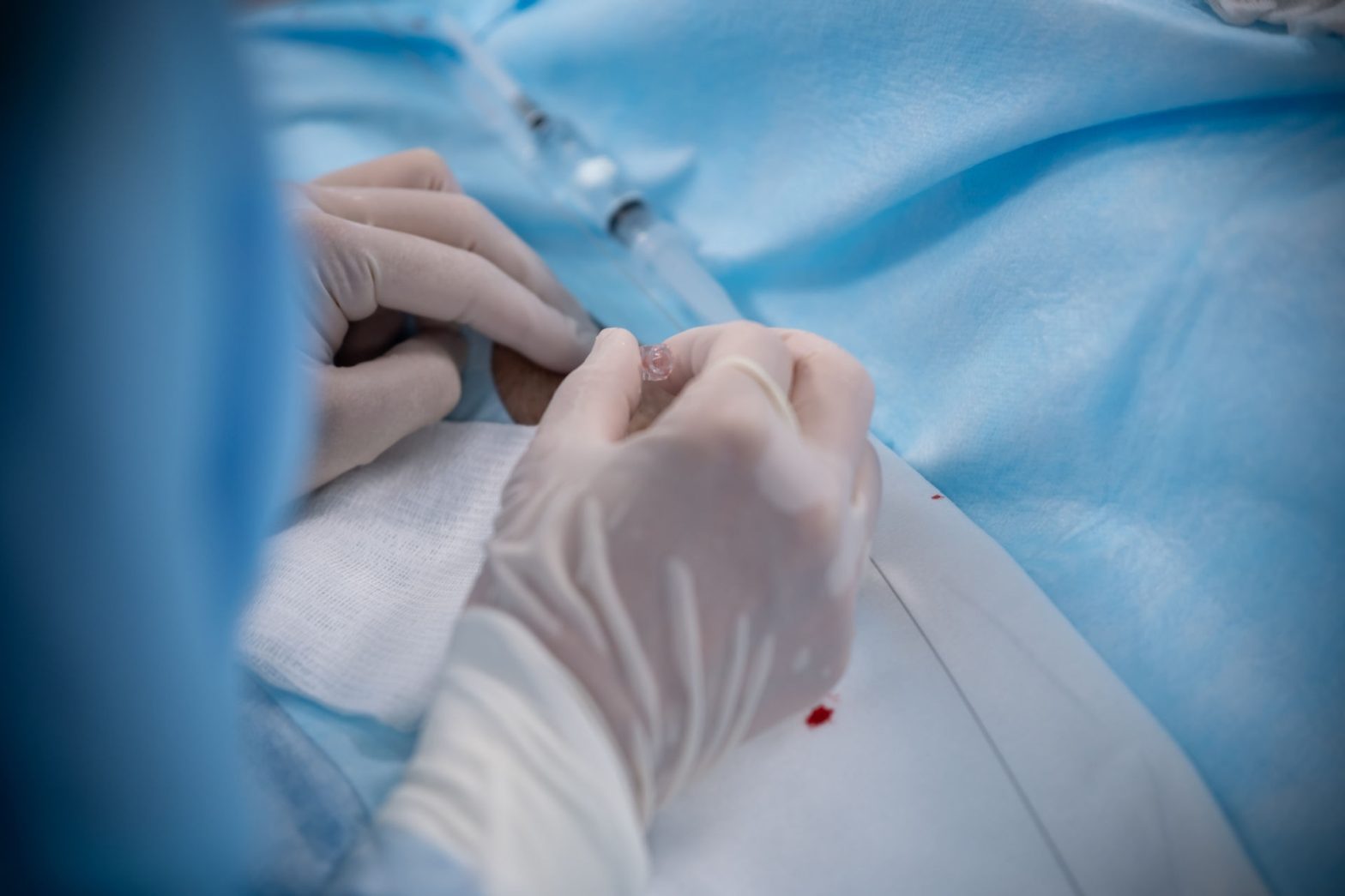 рентгенохирургические манипуляции