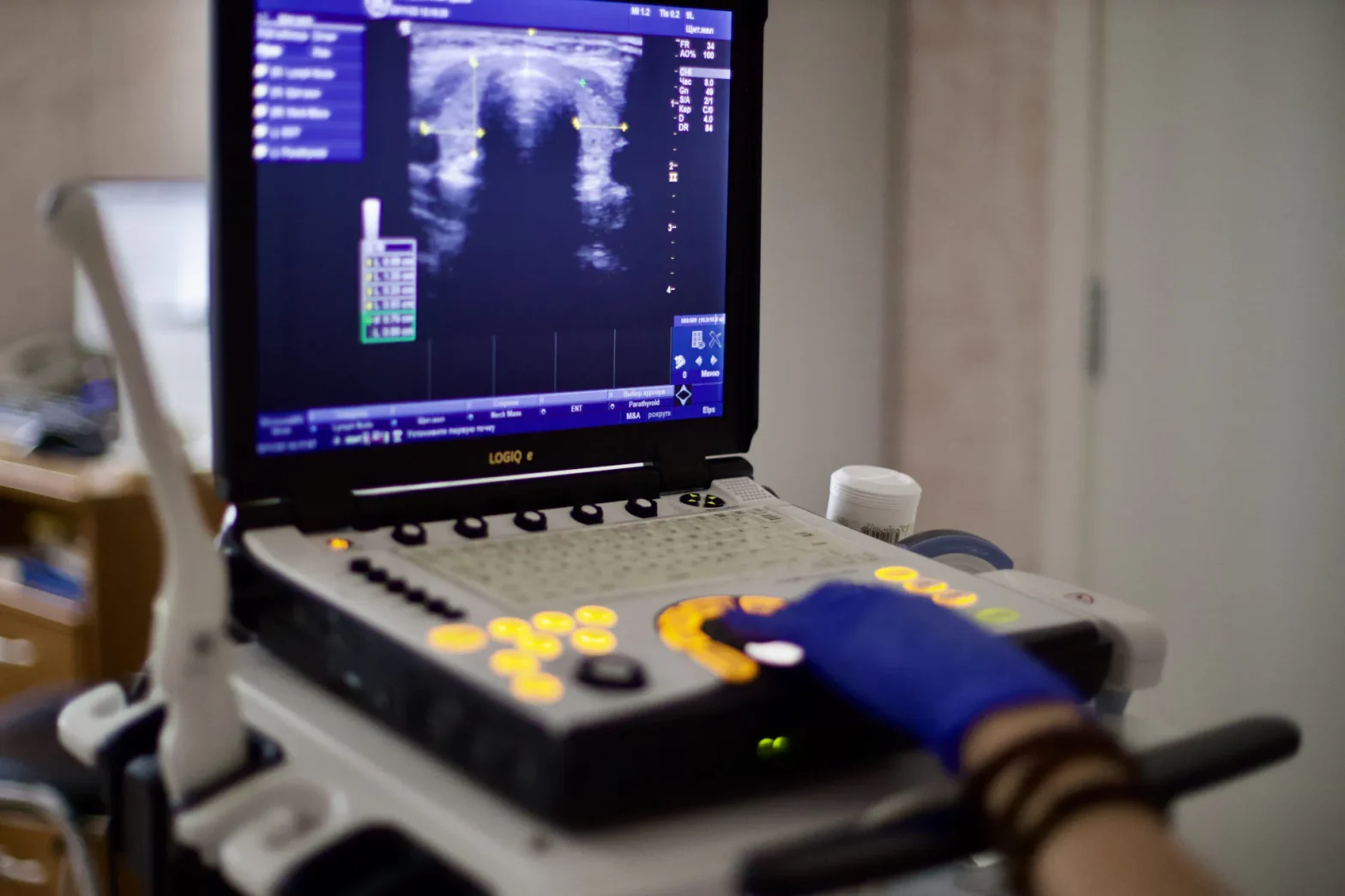 узи НМИЦ радиологии