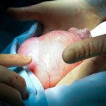 w fpycow63uvts1otx2rcvacafwoko3flsg2z2ywz27fleusyotyutr7oz5v8owwue83yn1qrak5mo6ocw7ppezd